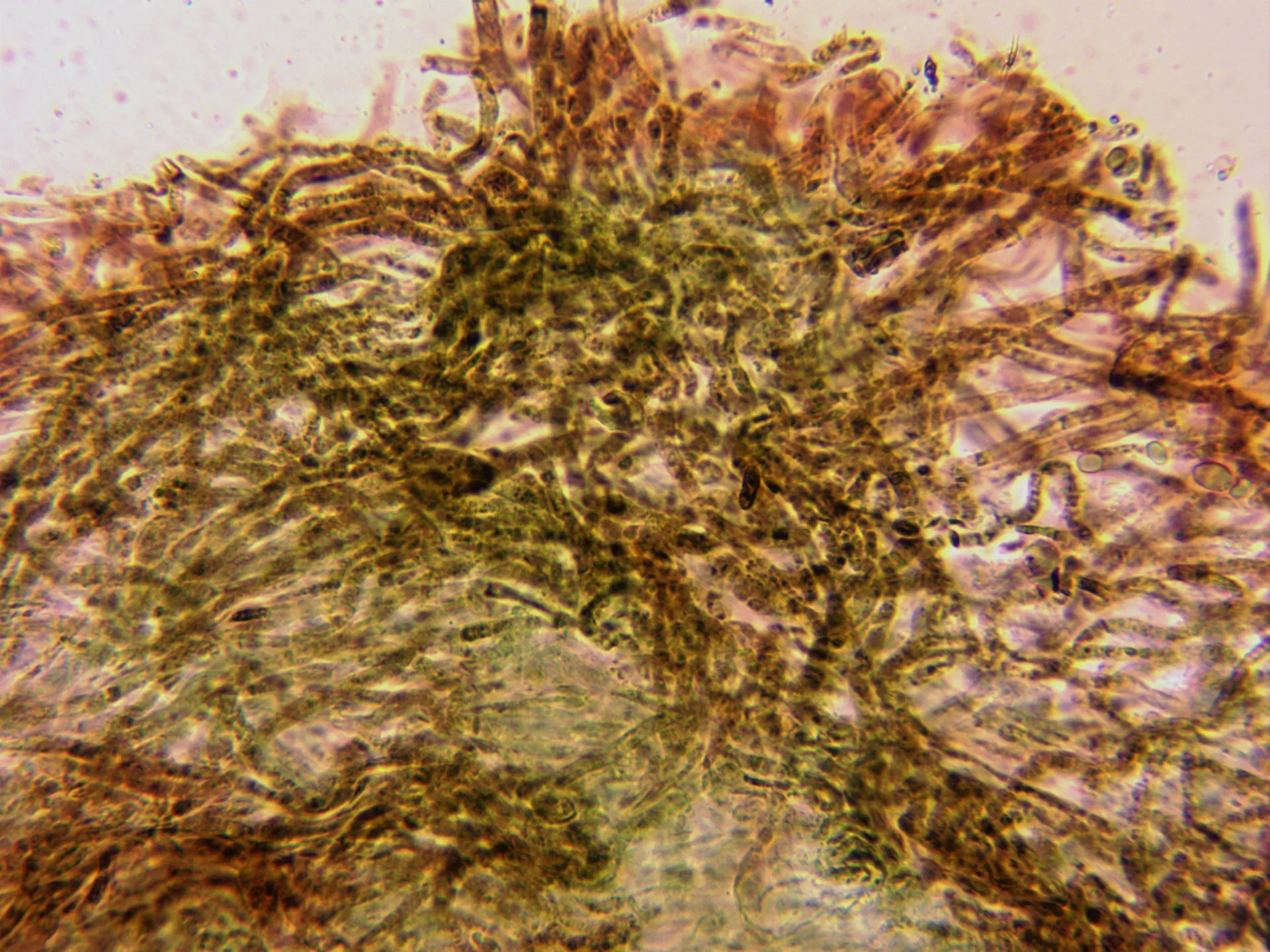 Microscopía de Tricholoma equestre - 16 - Cutícula x 400